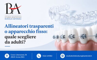 Allineatori trasparenti o apparecchio fisso: quale scegliere da adulti