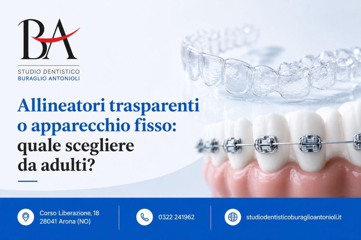 Confronto tra allineatori trasparenti e apparecchio fisso per adulti — Studio Buraglio Antonioli Arona
